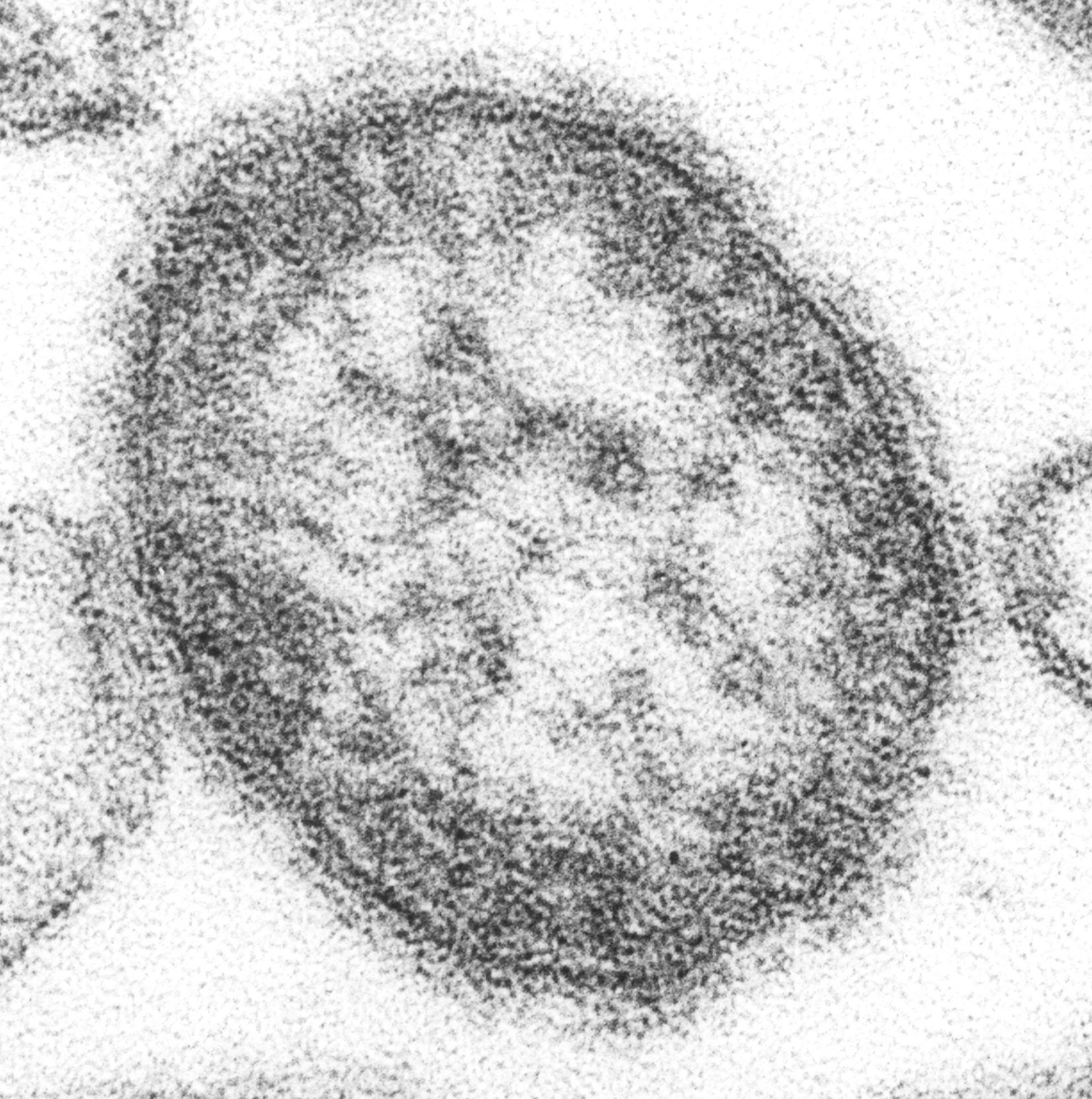 A grayscale electron microscope image of a single round measles virus particle with a dark outer envelope.
