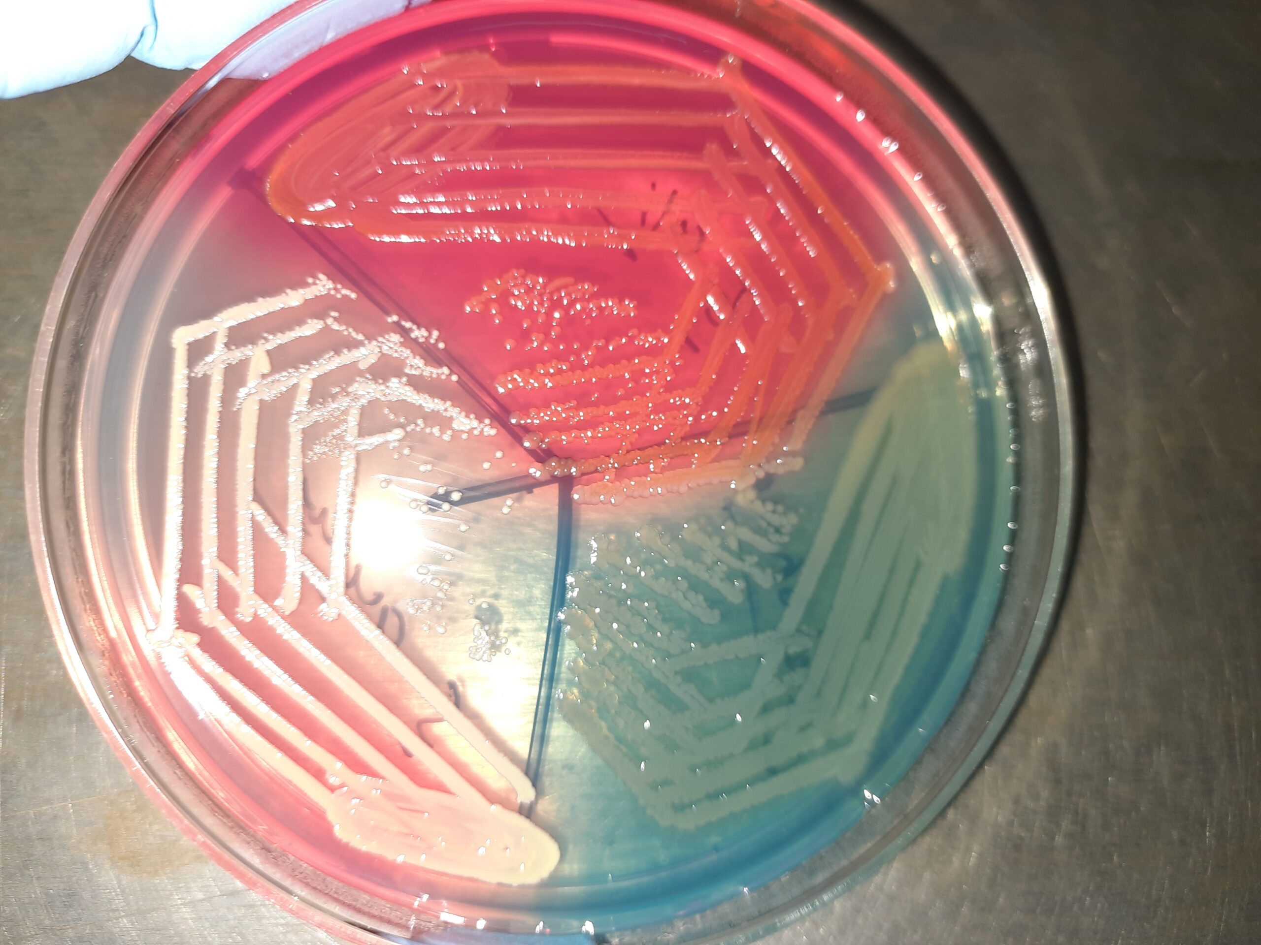 Bacterial colonies, including green-pigmented Pseudomonas aeruginosa, growing on a laboratory agar plate