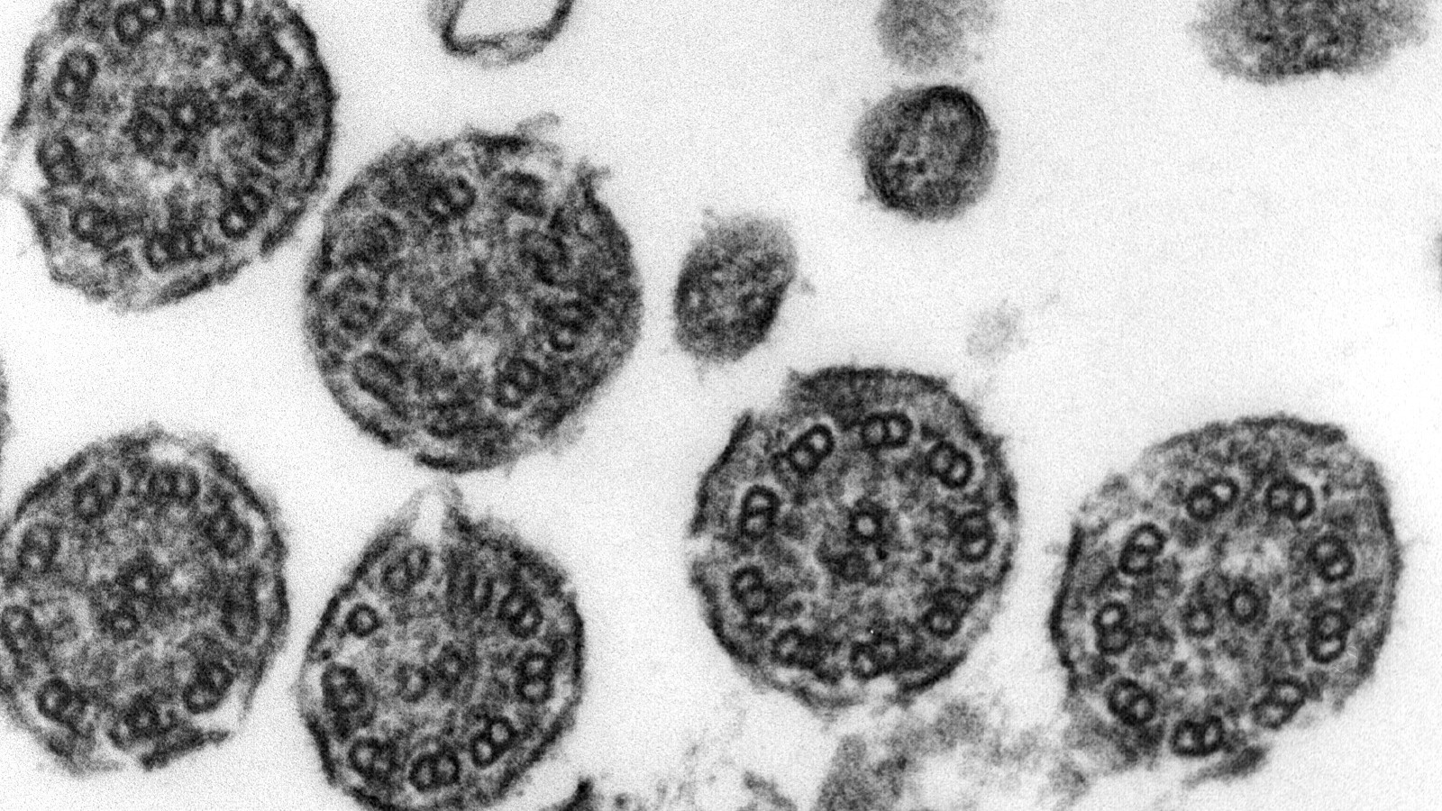 Black-and-white electron micrograph of several round cilia cross-sections in lung tissue, each showing a ring of paired microtubules around a central pair.