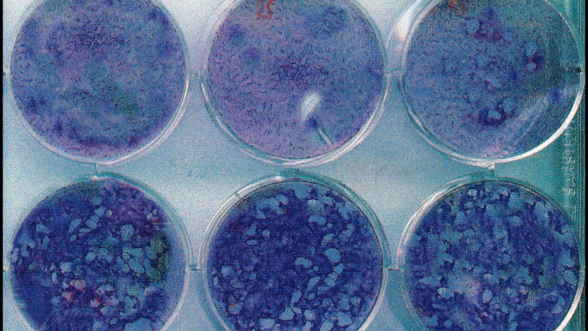 A six-well laboratory plate of blue-stained cell cultures, the lower wells showing pale holes where varicella zoster virus formed plaques.
